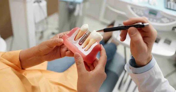 Un profesiona le explica como funciona un implante dental a un paciente